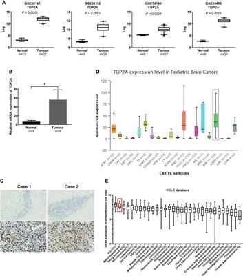 TOP2A correlates with poor prognosis and affects radioresistance of medulloblastoma